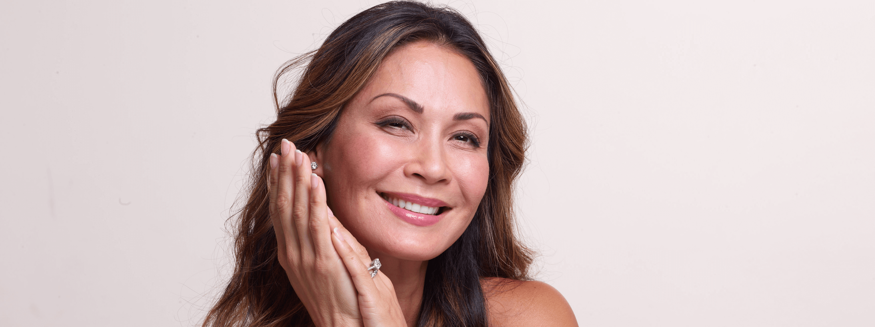 Restylane® patient demonstrates more youthful looking hands